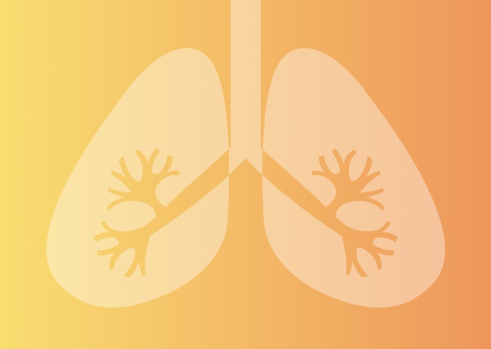 How Does RET-Positive Non-Small Cell Lung Cancer Spread