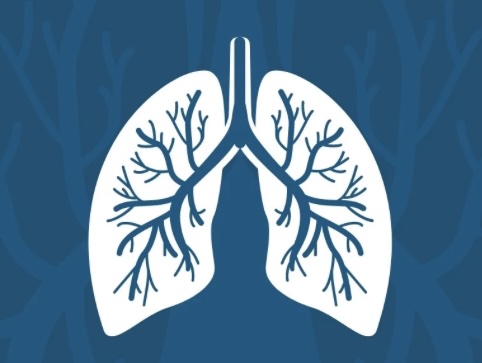 RET lung cancer genetic study